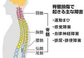 脊髄損傷で起きる主な障害